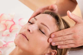 طب سوزنی در درمان میگرن؛ چرا سوزن‌ها روی سردردهای شدید تاثیر دارند؟